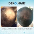 DEKO_Hair_results